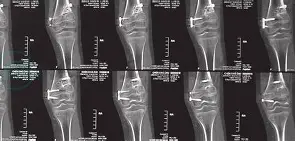 包含LPw&amp;?瘢$<婘?鋥r蜢的词条-英雄联盟S15队伍